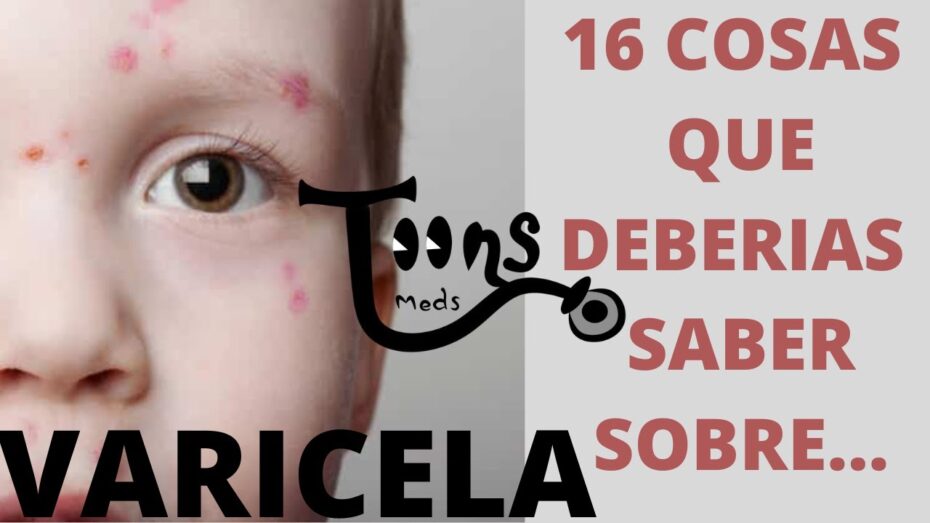Cómo actuar en caso de varicela en los niños