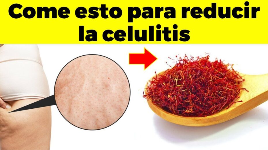 Cómo combatir la celulitis desde la alimentación