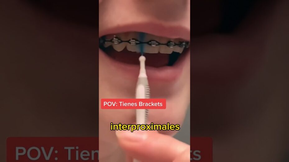 Cómo limpiar los brackets