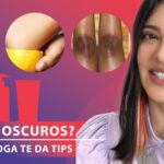 Cómo quitar las manchas de los codos Cómo quitar las manchas de los codos